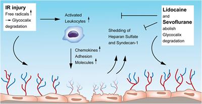 Novel Strategies for Endothelial Preservation in Lung Transplant Ischemia-Reperfusion Injury